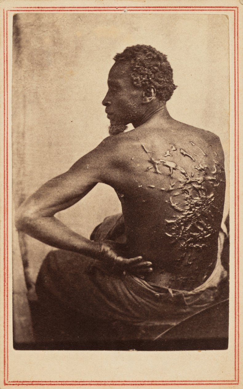 Bičovaná záda,c. 1863 (foto) od McPherson & Oliver