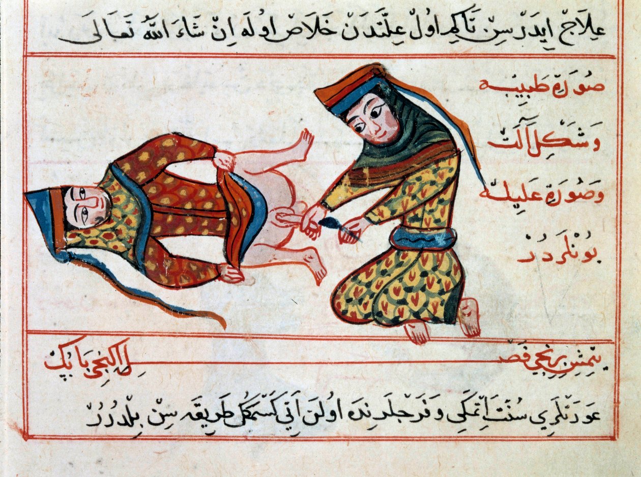 Medicína: operace hermafoditidy. Miniatura z pochoutky turecké medicíny od Sharaf al-dina od Ottoman School