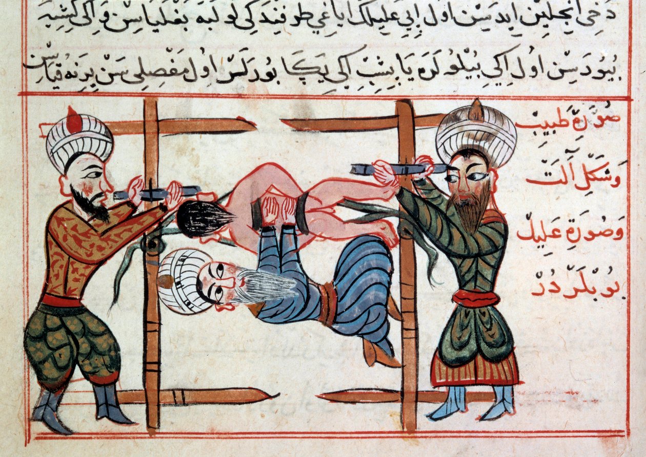 Redukce zlomeniny. Miniatura z pochoutky turecké medicíny od Sharaf al-dina od Ottoman School