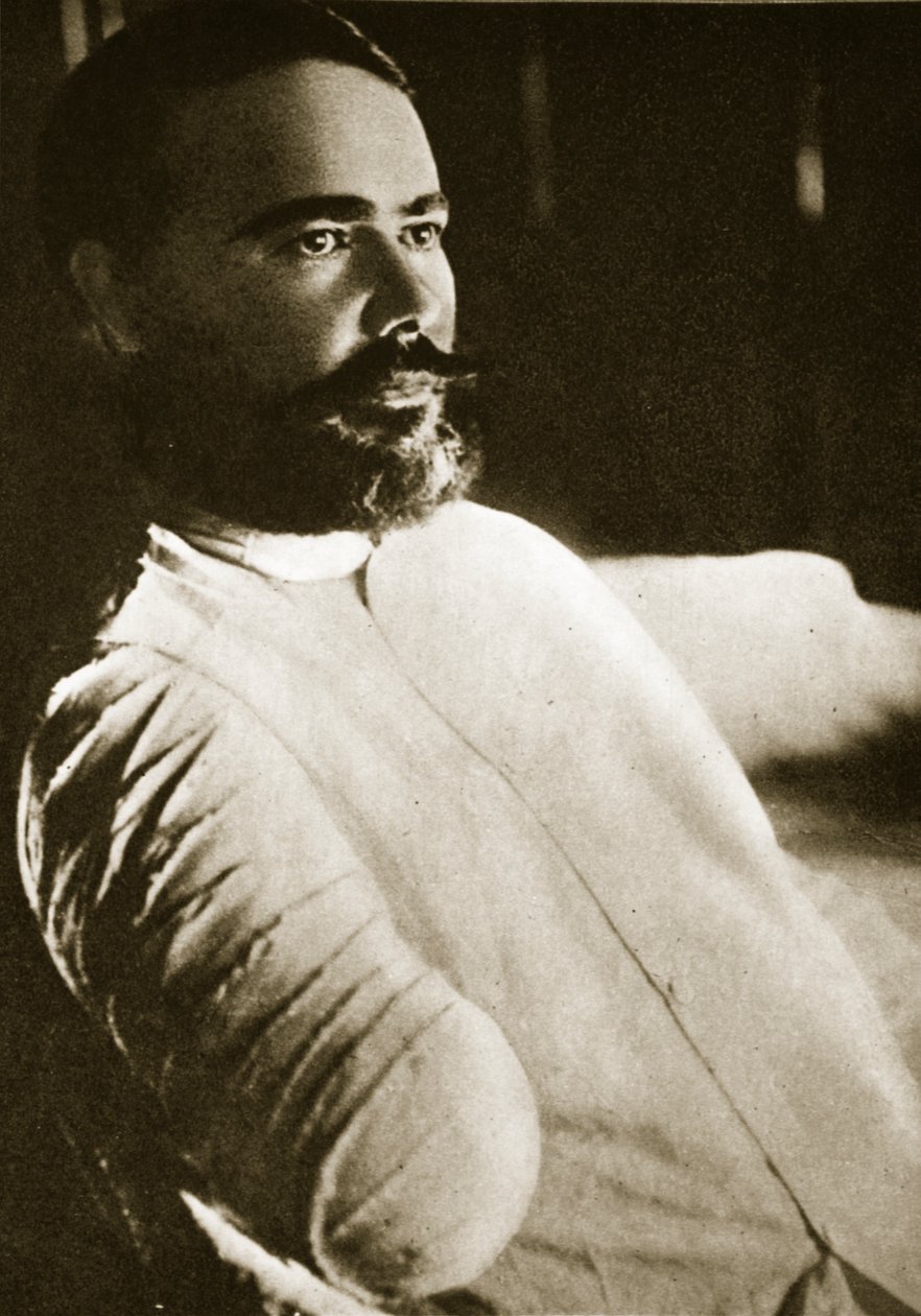 Generál Obregon poté, co mu v Santa Ana del Conde v roce 1915 odstřelil pravou ruku granát od Paul Thompson