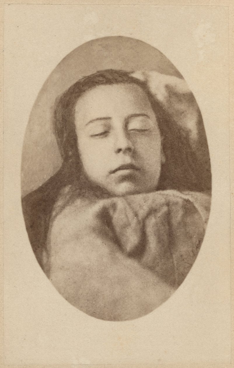 Záchvat hysterie, druhá fáze, ilustrace z "Iconographie Photographique de La Salpetriere" od Bourneville et P. Regnard, deska III, Paříž, 1876 (albumenový tisk) od Paul Regnard