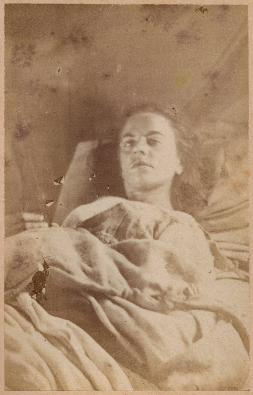 Hysterická epilepsie, záchvat, třetí období, deska XXVI z „Iconographie Photographique de La Salpetriere“ od Bourneville et P. Regnard, Paříž, 1876 (tisk alba) od Paul Regnard