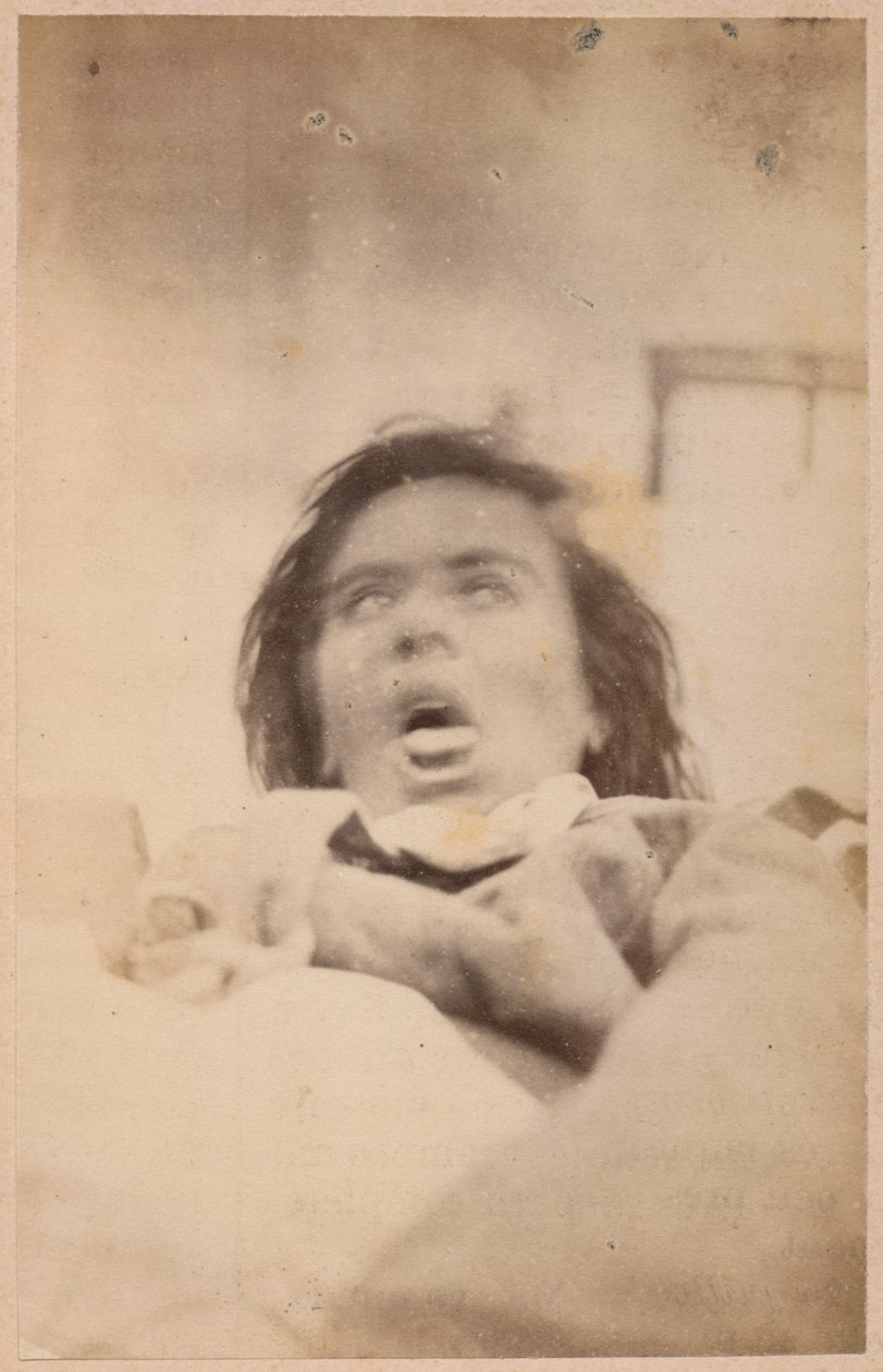 Hysterická epilepsie, halucinace, úzkost, deska XXIX z „Iconographie Photographique de La Salpetriere“ od Bourneville a P. Regnarda, Paříž, 1876 (tisk alba) od Paul Regnard