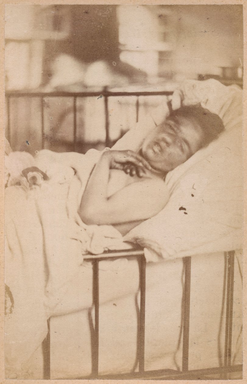 Hysterická epilepsie, permanentní kontrakce, deska XXVIII z knihy "Iconographie Photographique de La Salpetriere" od Bourneville et P. Regnard, Paříž, 1876 (albumenový tisk) od Paul Regnard