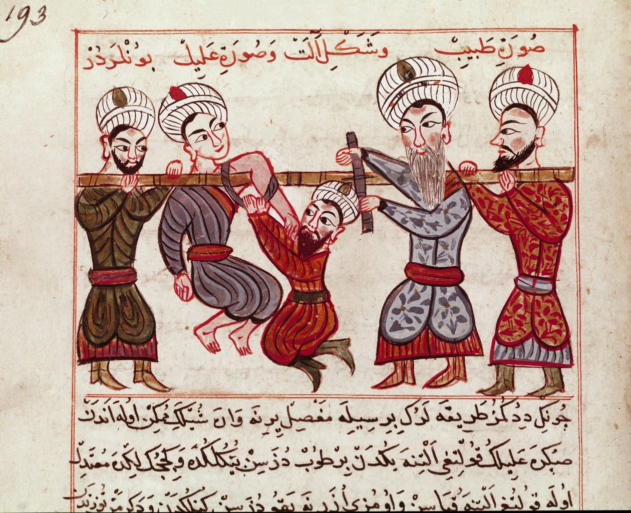 Medicína: ortopedická intervence. Miniatura pořízená z dojení turecké medicíny Charaf-ed-dinem (Charaf ed Din) (1404-1468) po „“La Surgery Imperiale““ (Ms Sup Turk 693 fol. 193) 1466 Paris, B.N. od Persian School