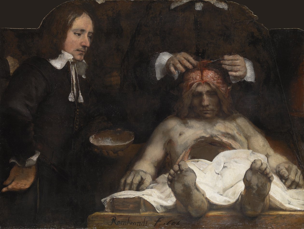 Lekce anatomie Dr. Jana Deymana, 1656 od Rembrandt van Rijn
