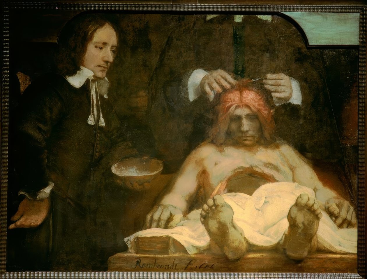 Anatomie Dr. Johan Deijman od Rembrandt van Rijn