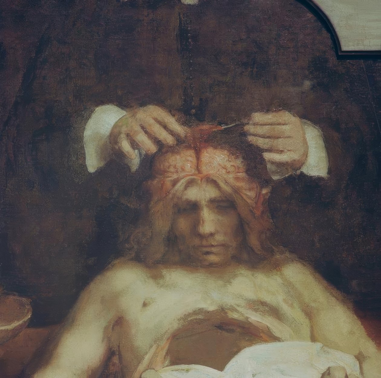 Anatomie Dr. Johan Deijman od Rembrandt van Rijn
