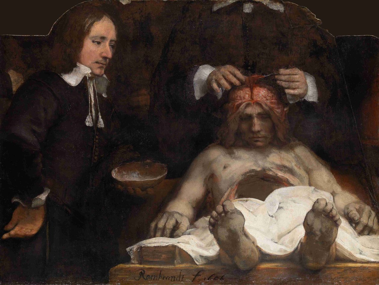 Lekce anatomie Dr. Jana Deijmana, 1656 od Rembrandt van Rijn