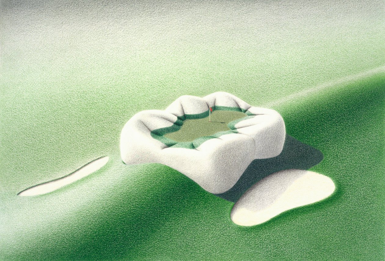 Inlay od Rene Boin
