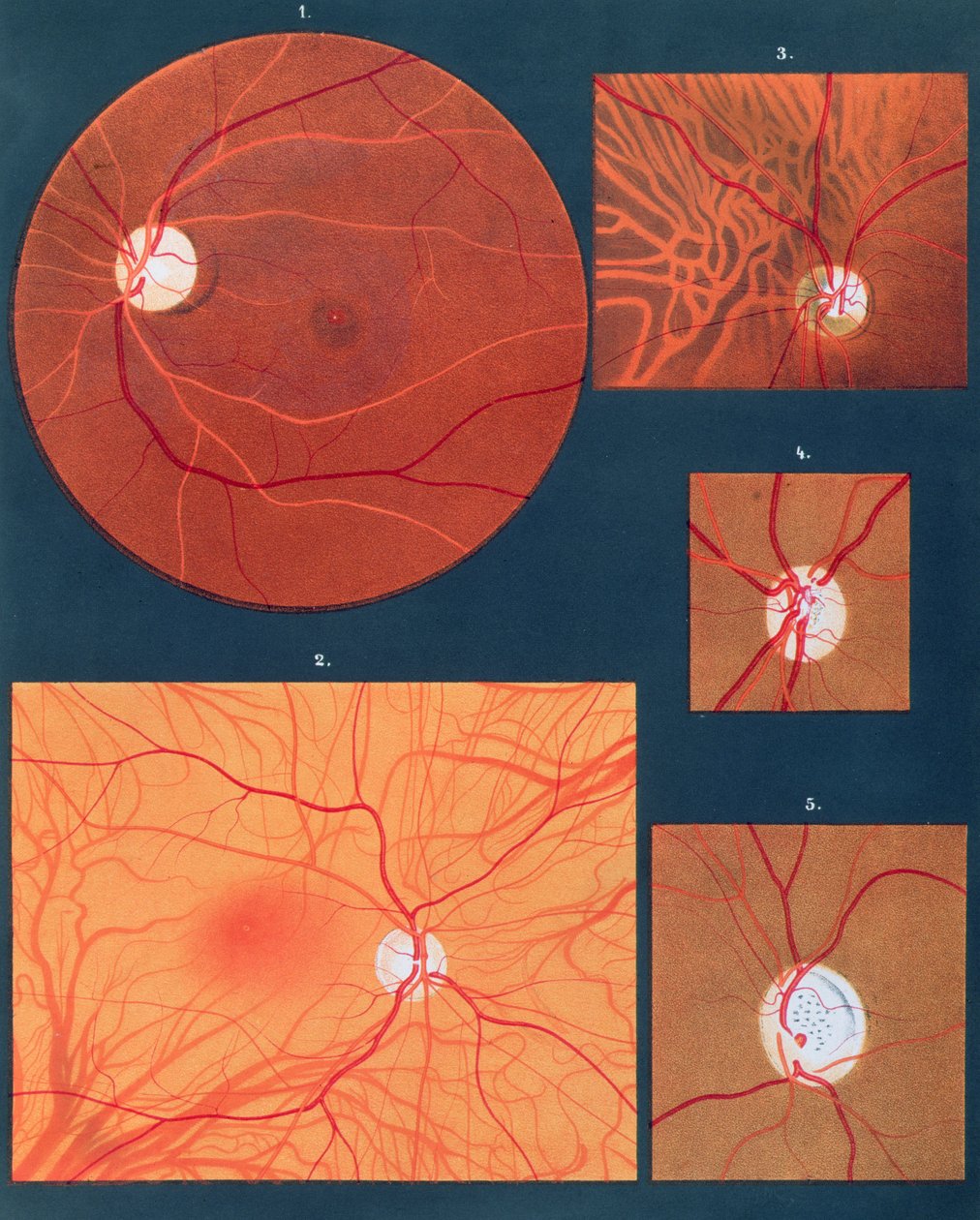 Oko v mikroskopu, z knihy Atlas of Ophthalmoscopy, vydané v Paříži roku 1870 (chromolit) od Richard Liebreich