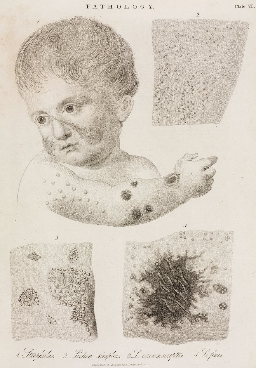 Dermatologie Typy kožních onemocnění od John Pardon