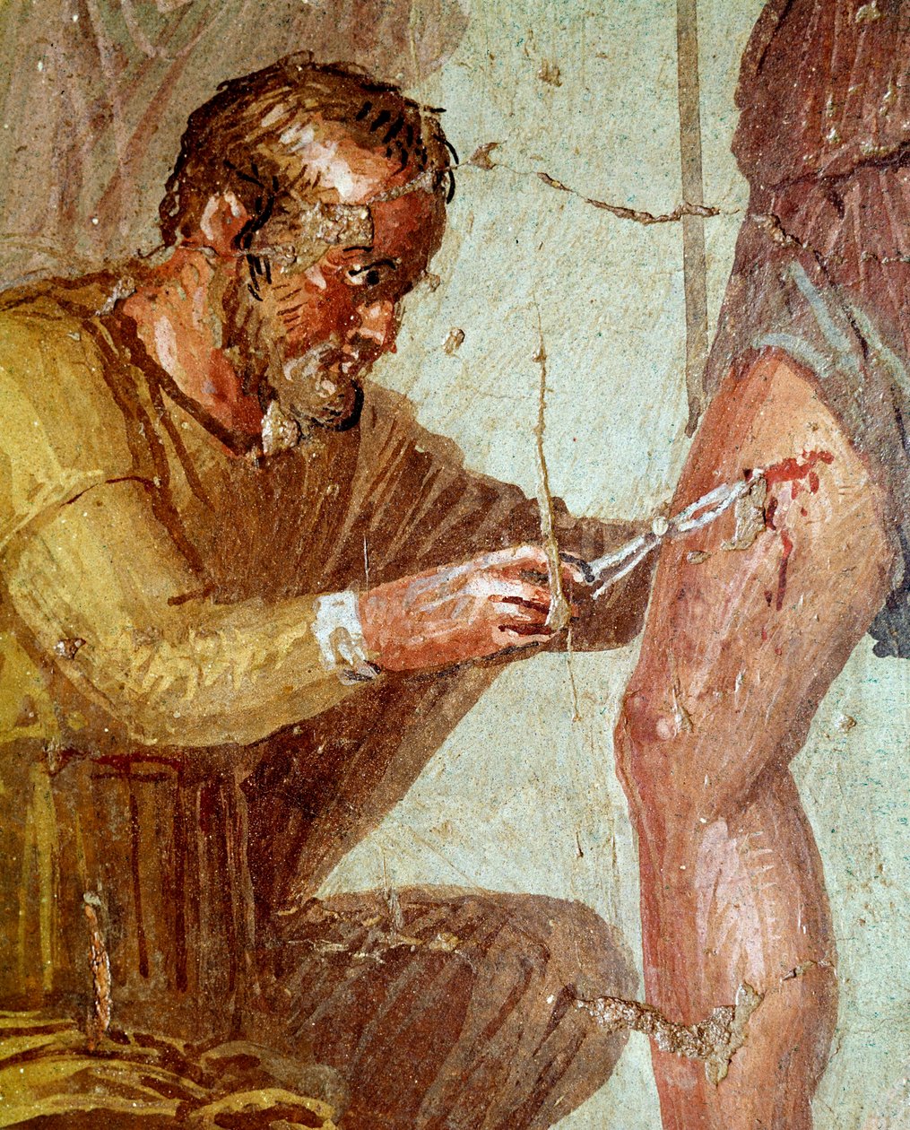 Zraněný Aeneas je ošetřen Iapyxem s pomocí Venuše (freska, 54-79 n. l.) od Roman