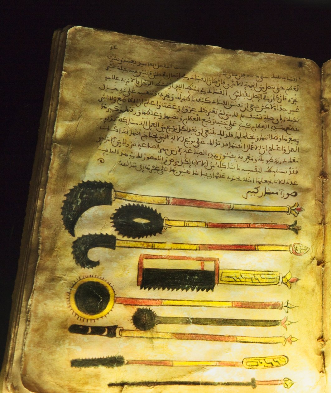 Ilustrace z knihy "O chirurgii a nástrojích" neboli "Al-Zahrawi" od Abu al-Qasim al-Zahrawiho. od Unbekannt Unbekannt