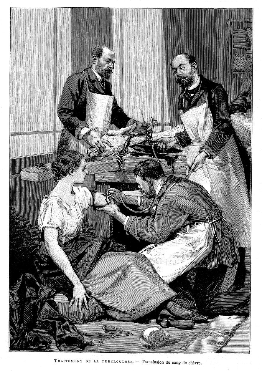 Pacientovi s tuberkulózou byla podána transfuze kozí krve, 1891 od Unbekannt