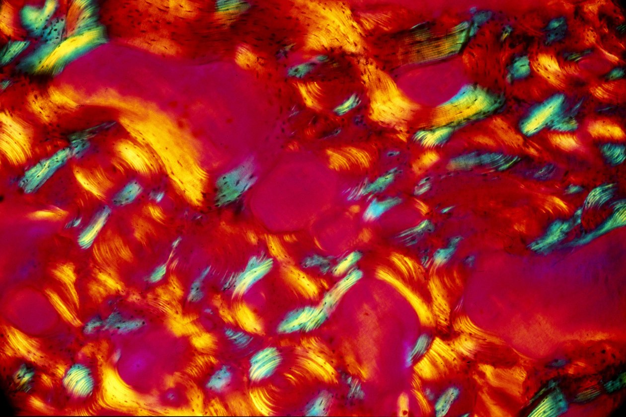 BIO-MATERIÁLY, LM Bone od Unbekannt