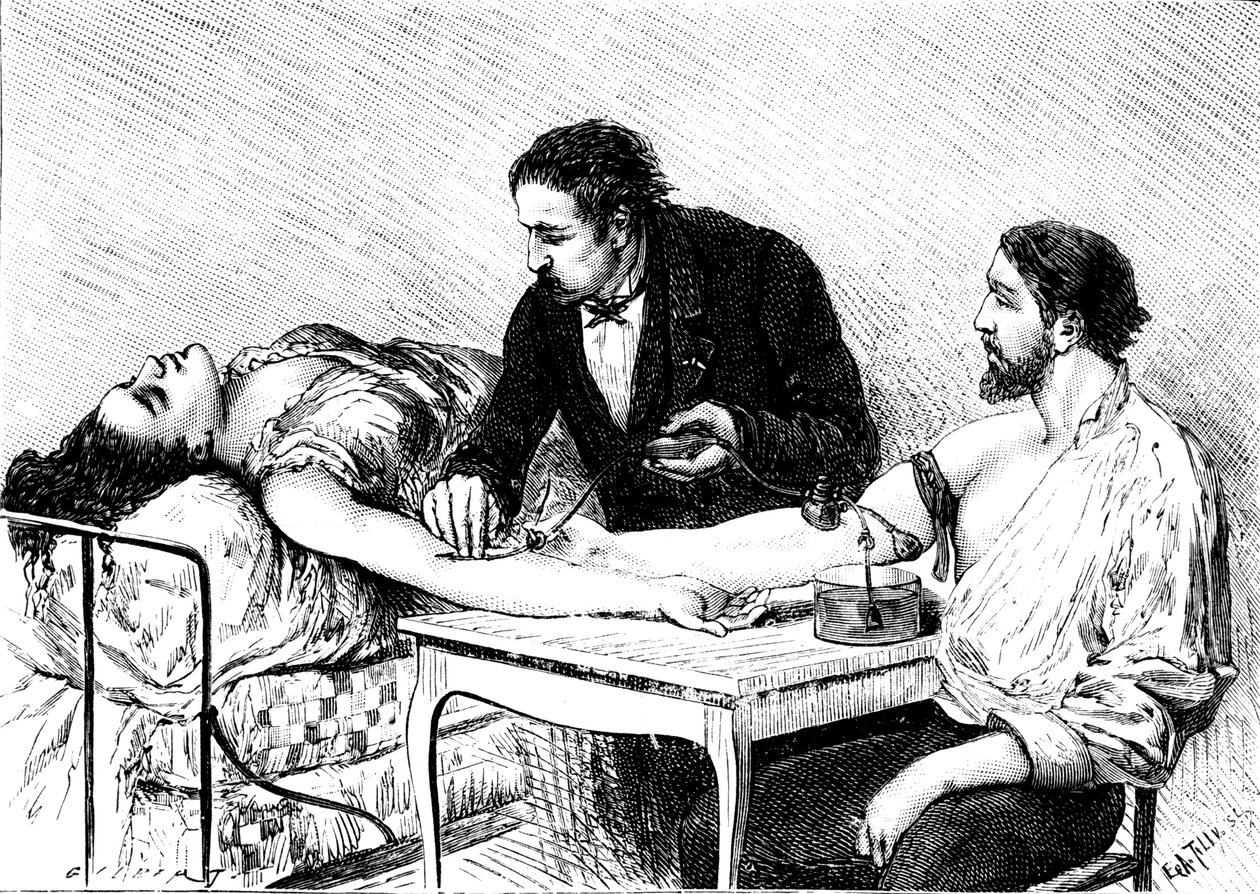 Dr. Roussell ze Ženevy, který dal ženě přímou krevní transfuzi od dobrovolníka, 1882 od Unbekannt