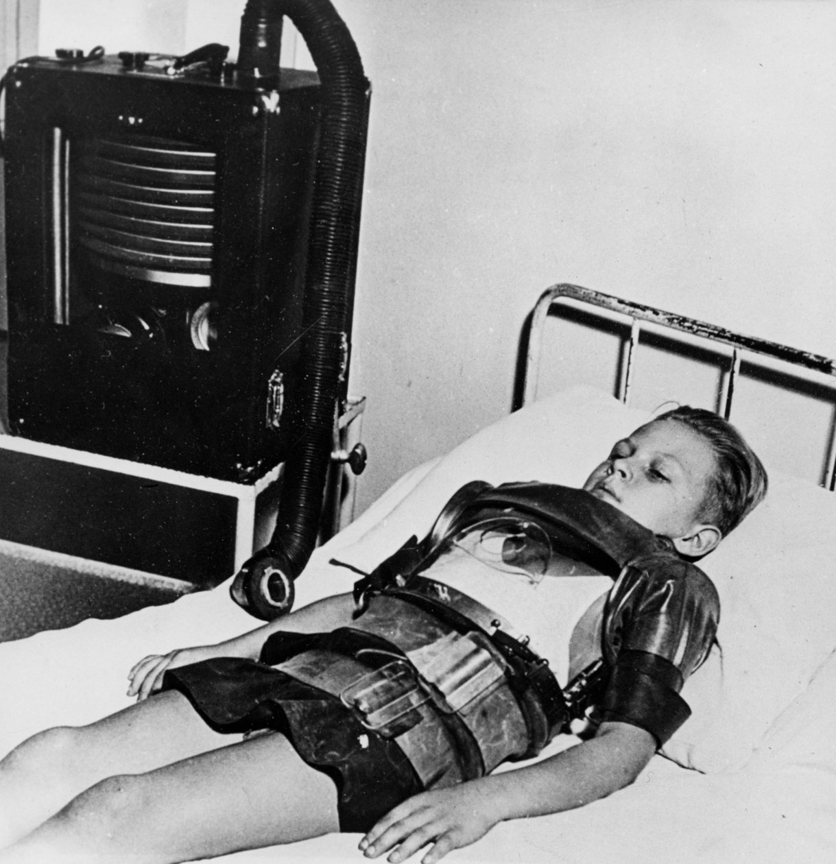 Jedenáctiletý chlapec v železných plicích, nemocnice Beaujon, Paříž, c1947-1951 od Unbekannt