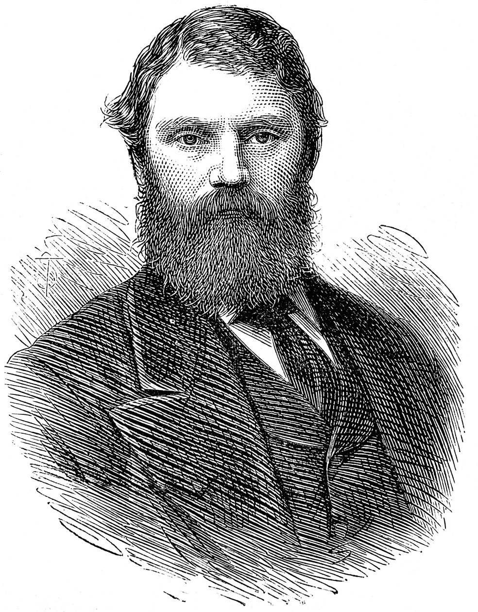 Francis Edmund Anstie 1833-1874, anglický lékař, 1874 od Unbekannt