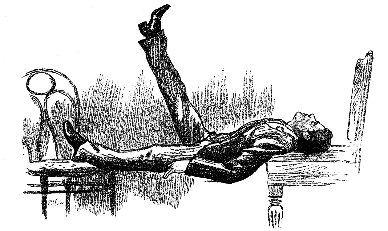 Hypnotizovaný subjekt ve stavu katalepsie, 1891 od Unbekannt