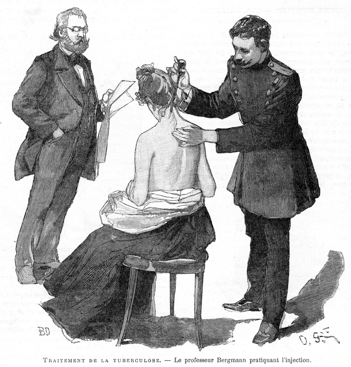Profesor Bergmann injekčně podával pacientovi s tuberkulózou, 1891 od Unbekannt