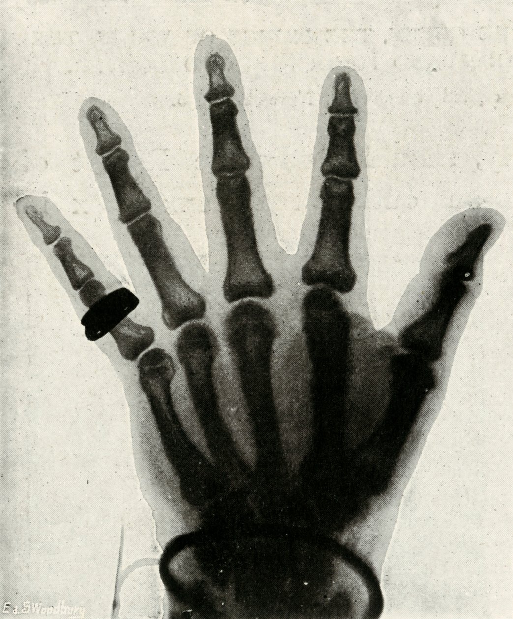 Rentgenový snímek ruky H.R.H. Princ z Walesu, c1897 od Unbekannt