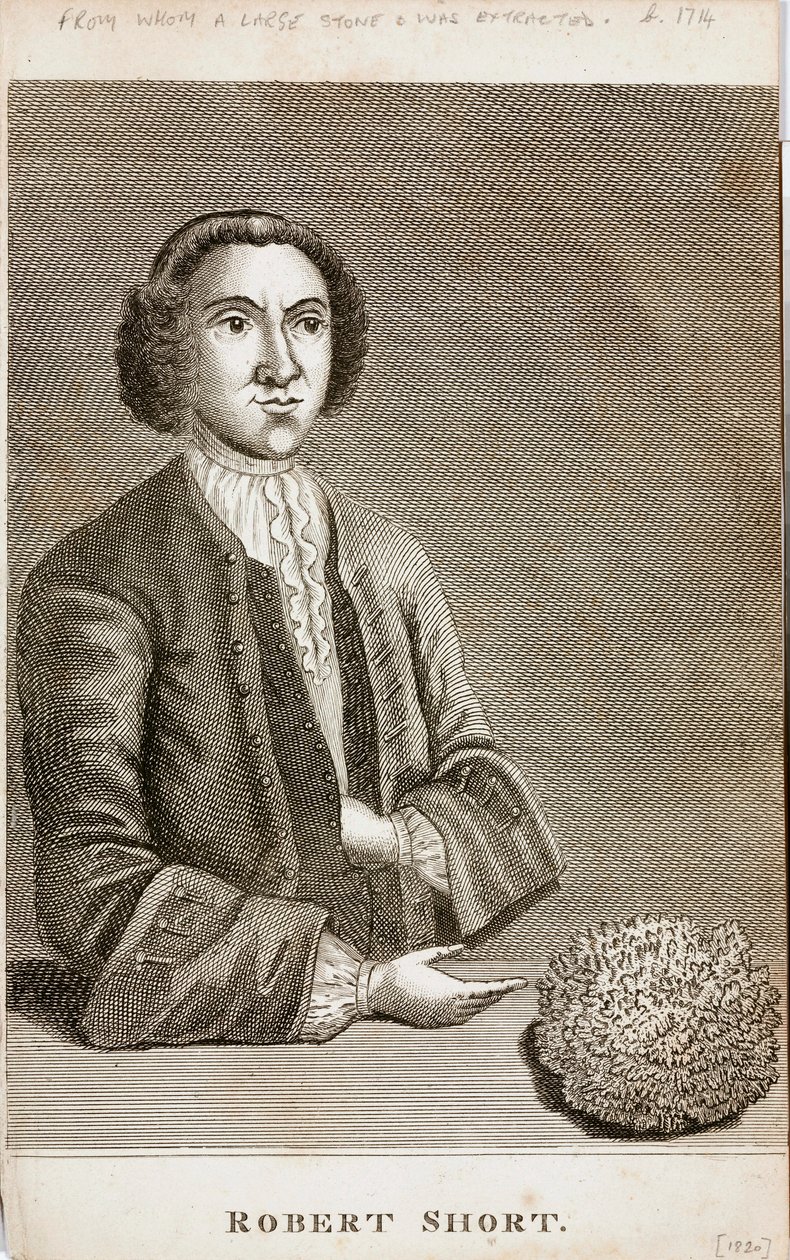 Robert Short, lékařská kuriozita, c 1750 od Unbekannt