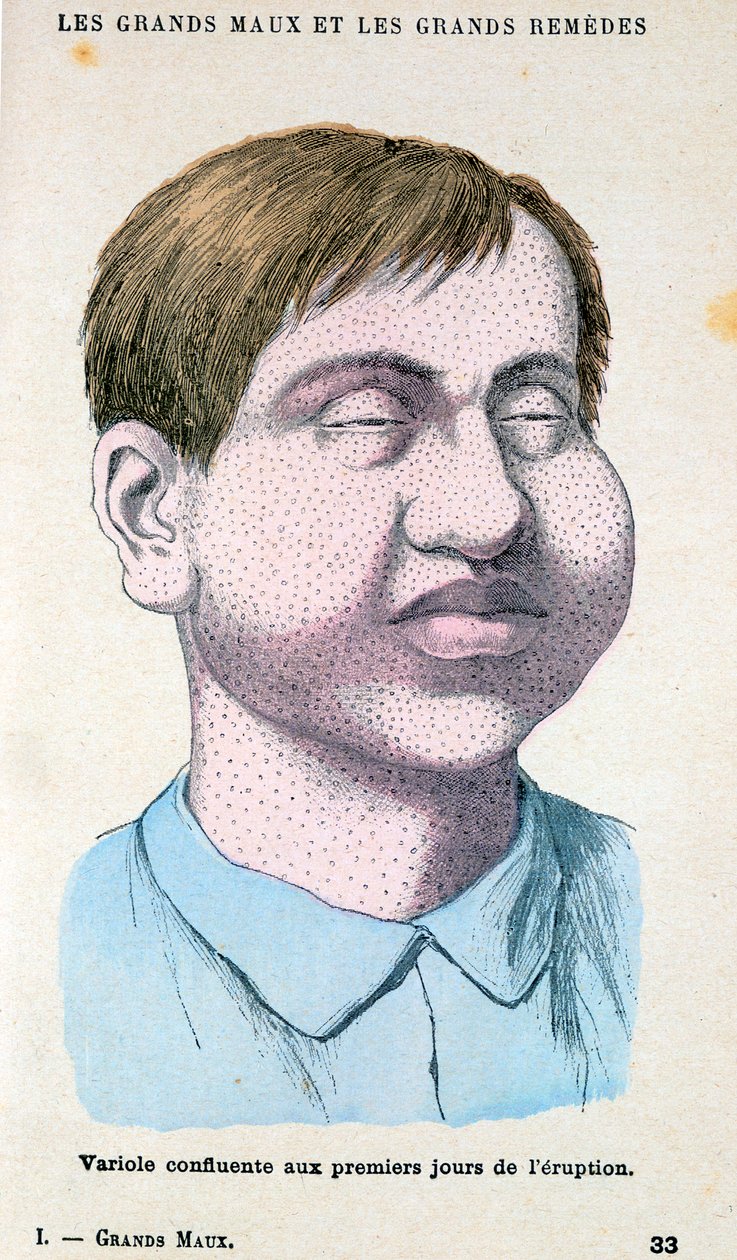 Oběť neštovic, c1890 od Unbekannt