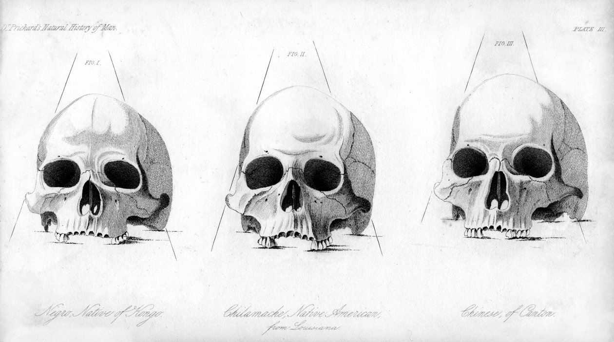 Tři typy lidské lebky, 1848 od Unbekannt