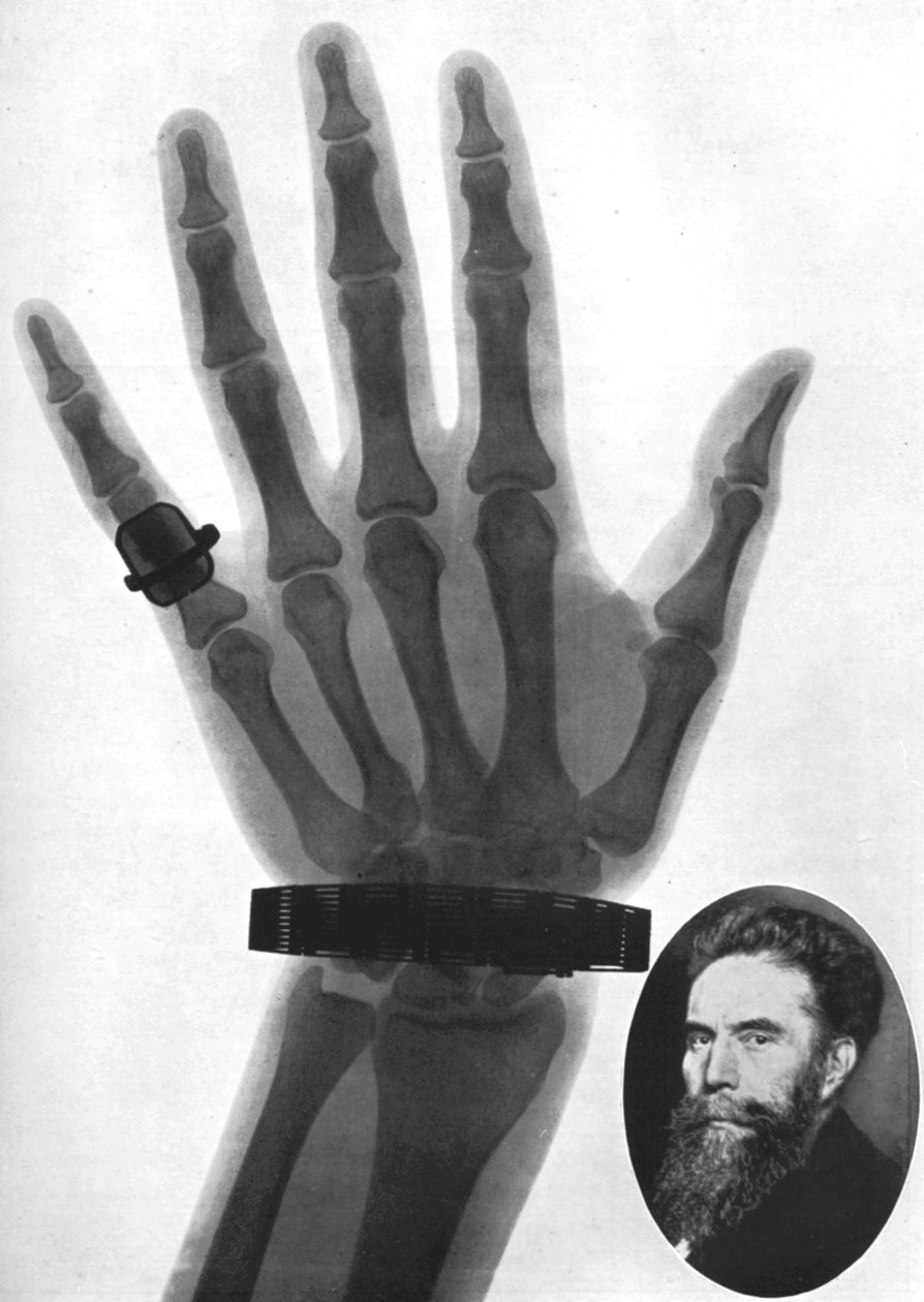 Rentgenová fotografie ruky, 1926 od Unbekannt