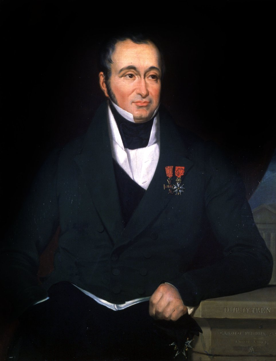 Doktor Dupuytren, asi 1820 (obraz) od Unbekannter Künstler