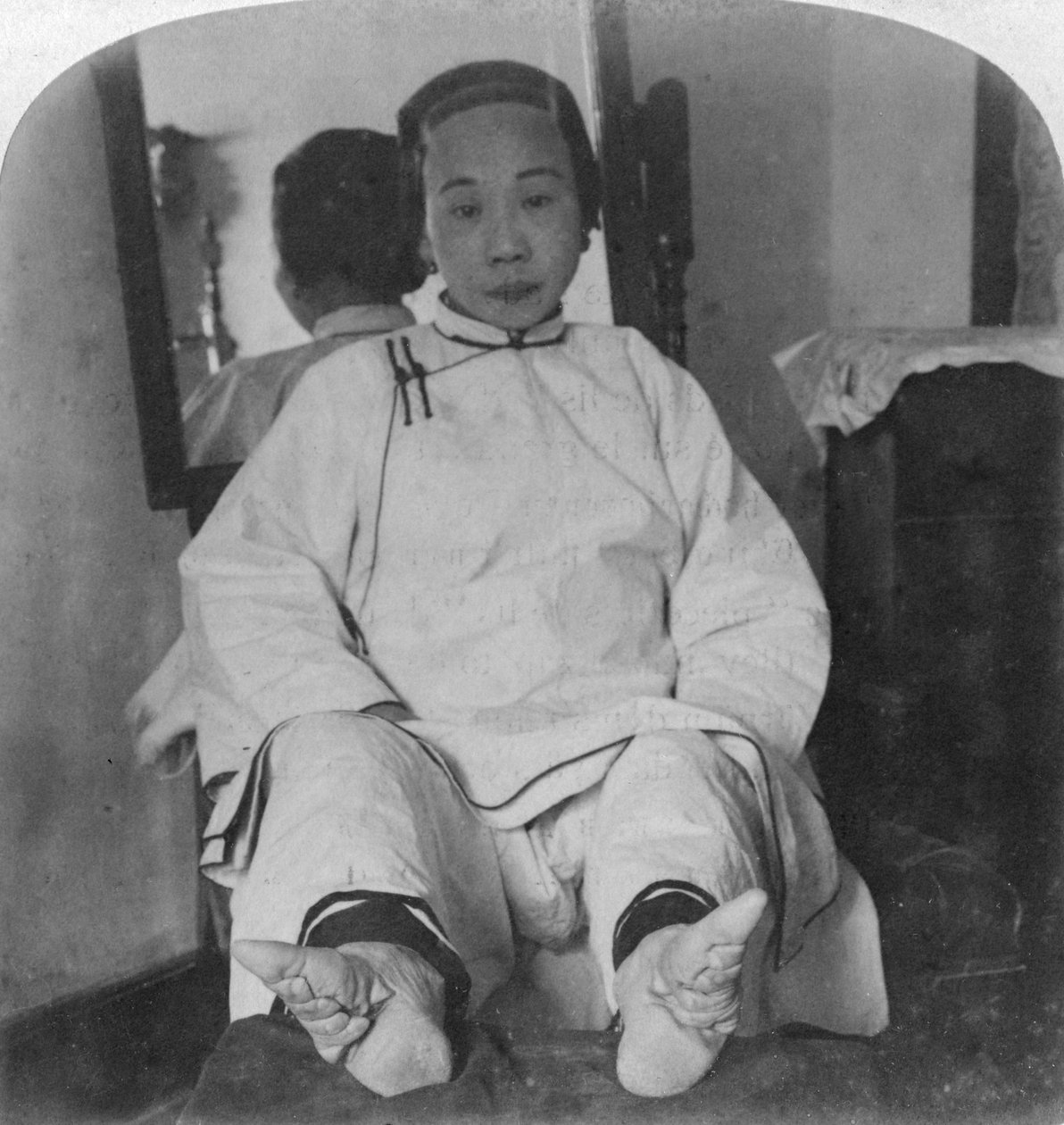 Delikátní nohy lilií vysoké kasty, ukazující metodu deformace, Čína, 1900. od Underwood and Underwood