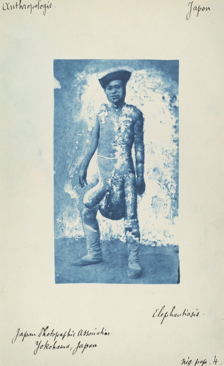 Elefantiáza od Unknown 19th Century
