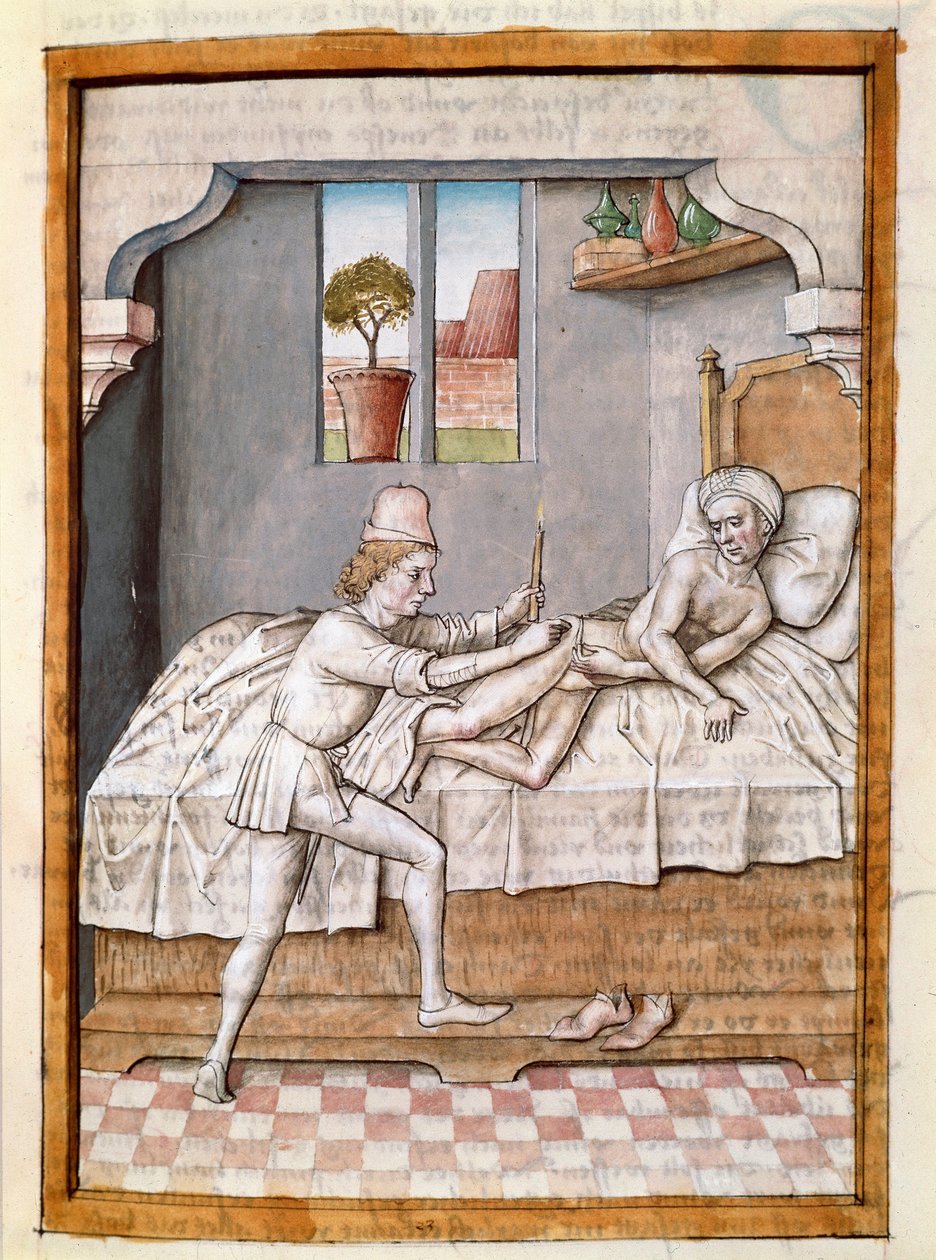 Lékař ošetřuje miniaturního pacienta z německého překladu bajek „Kalila (Calila) a Dimna“ od Bidpaie. (ms. 1389, fol. 23) kolem 1480 Chantilly, muzeum Conde od Unknown artist