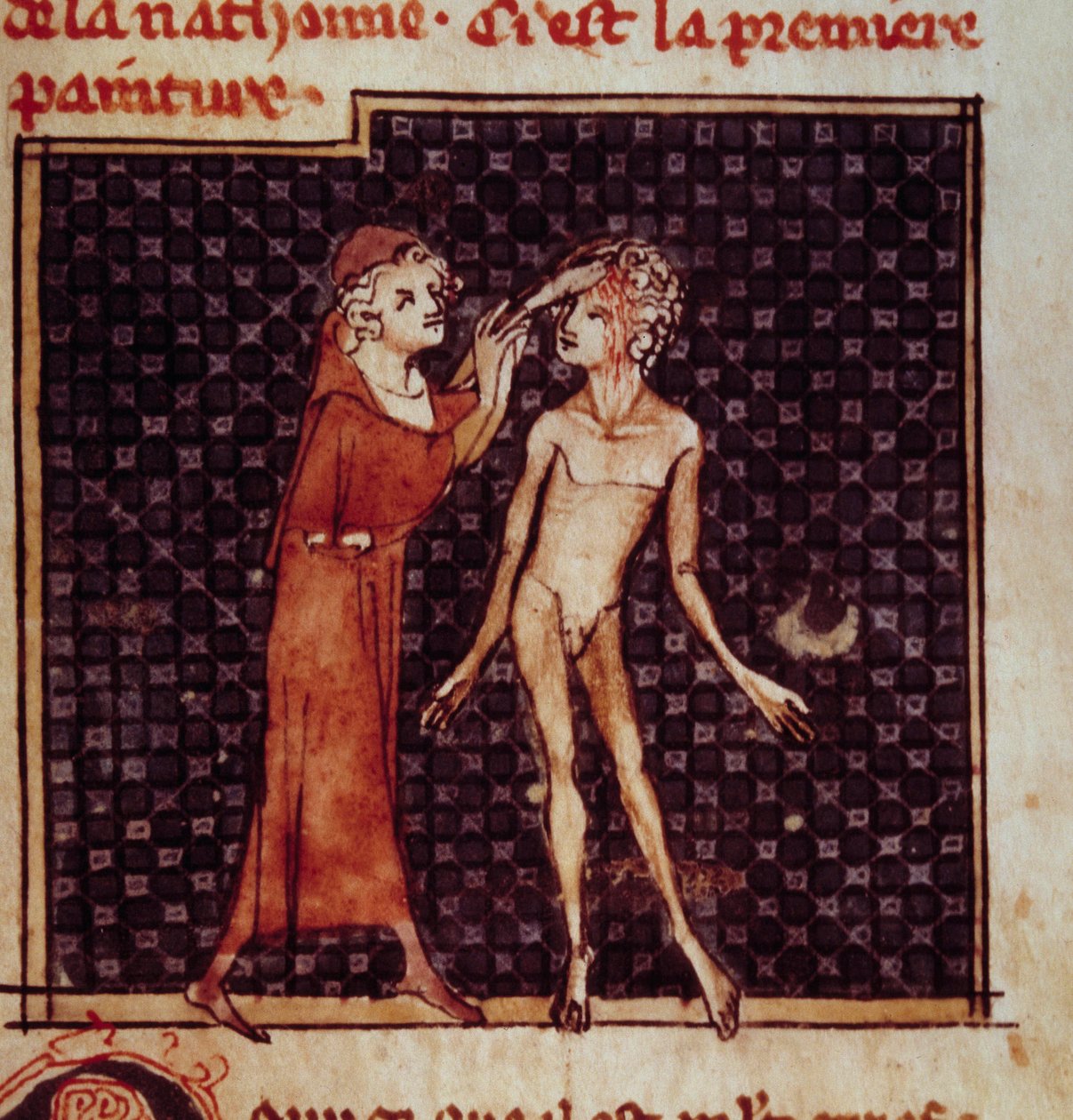 Anatomická postava: Chirurg nařízne pacientovo čelo. Miniatura z rukopisu „“ Chirurgie“ (Folio 8) od Henriho de Mondeville (chirurg Philippe Le Bel, profesor anatomie) od Unknown artist