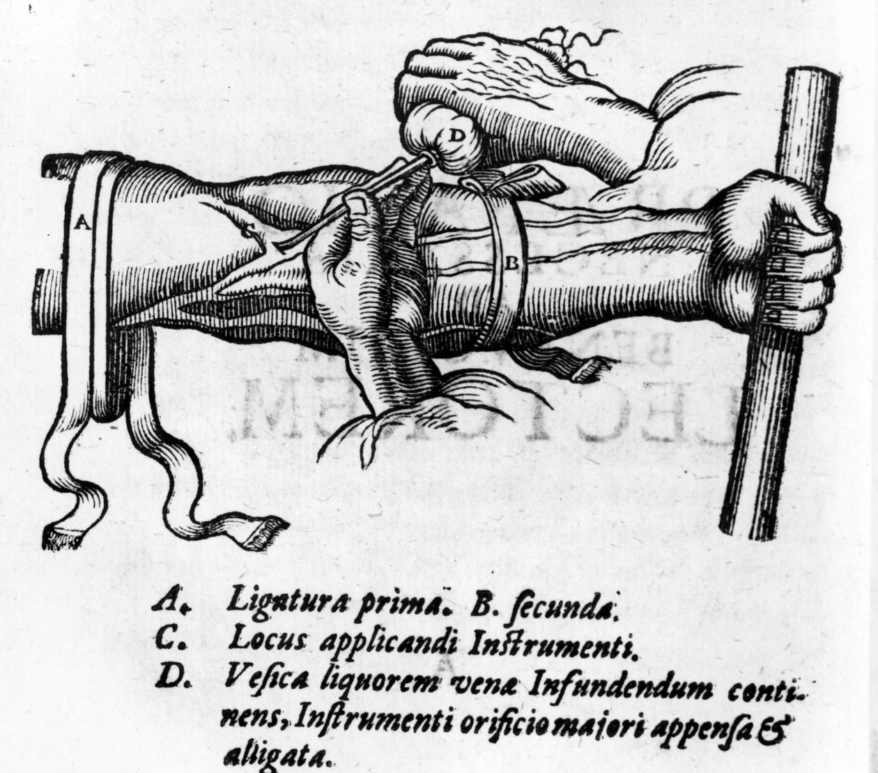 Anatomická deska: různé ligatury. Práce o krevním systému od Williama Harveyho (1578-1657), anglického lékaře. Popsal cirkulaci krve v těle prostřednictvím žil od Unknown artist
