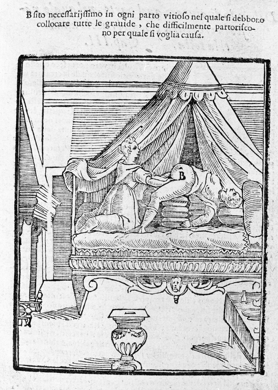 Porodní scéna po "Della Commare" od Scipione Mercuri od Unknown artist