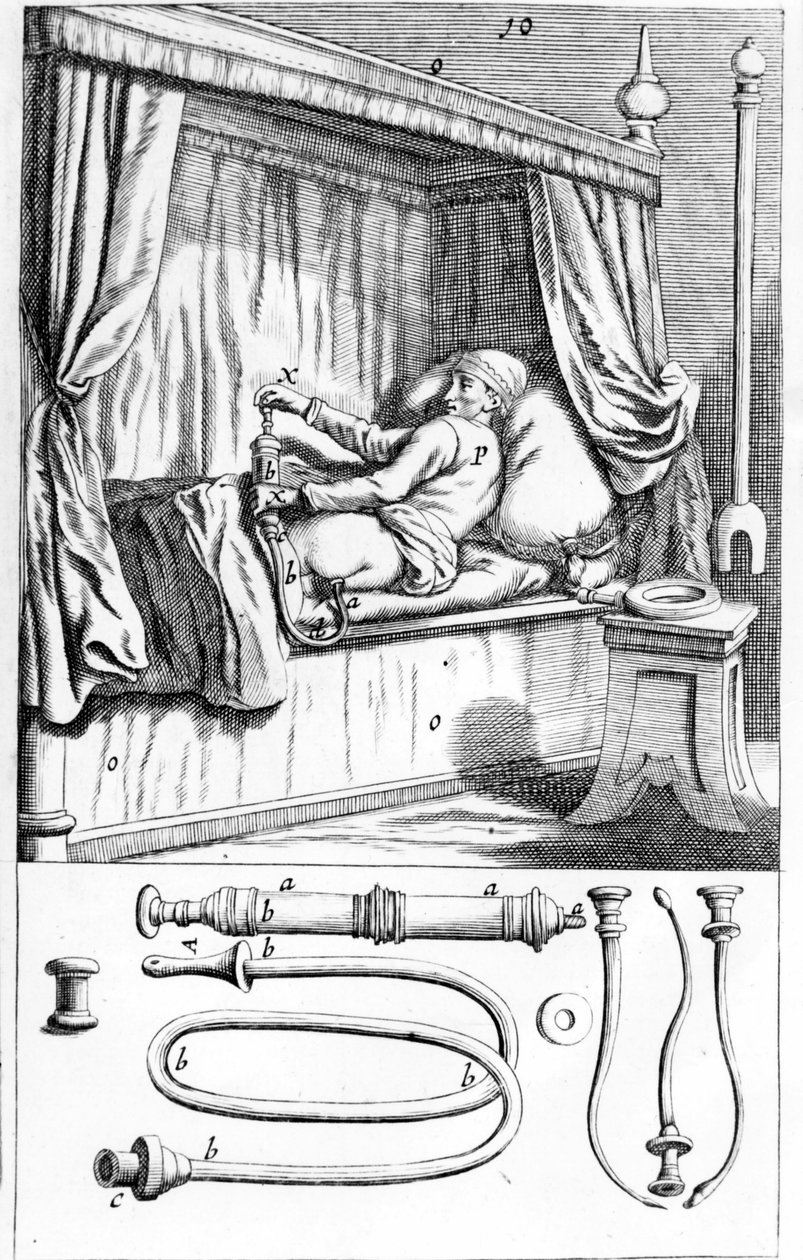 Clystère (pro klystýry) od Johannese Sculpteta „“Armamentarium Surgical““. Benátky 1665 od Unknown artist