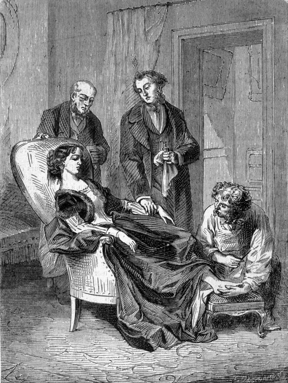 Deces dívky Hannah Greener ve věku patnácti let po jedné z prvních chloroformových narkóz 28. ledna 1848. Rytina z roku 1869. od Unknown artist
