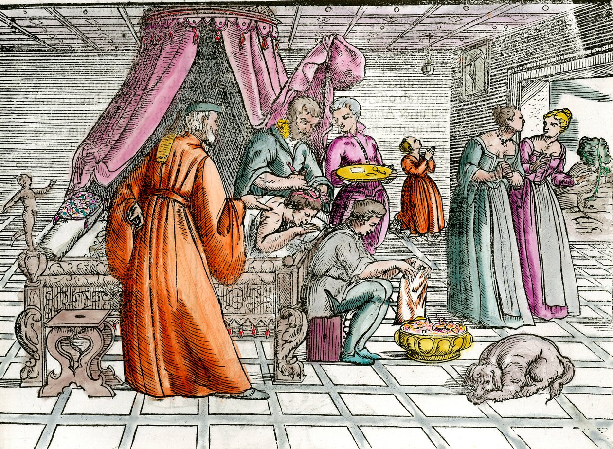 Doktor: „“ Trepanace“““ Chirurg operuje pacientovu lebku. Rytina soukromé sbírky 16. století od Unknown artist
