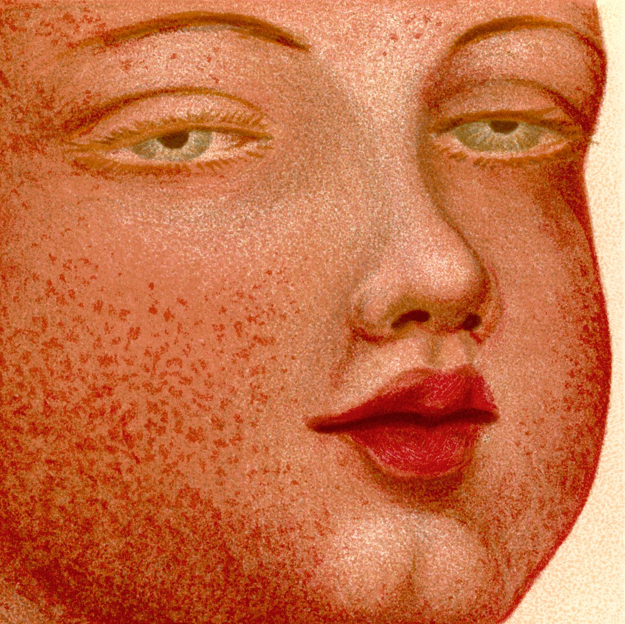 Eruptivní horečky: Scarlatina nebo Scarlet Fever od Unknown artist