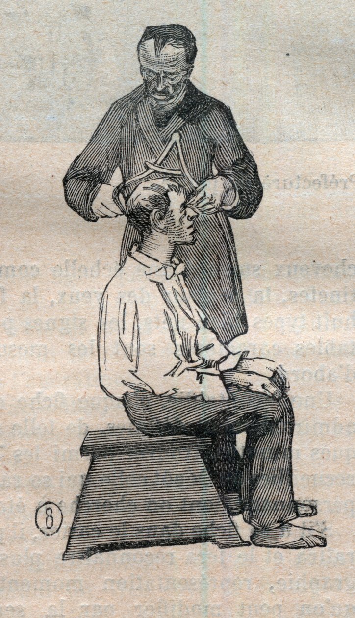 Soudní antropometrie neboli bertillonnage, metoda Alphonse Bertillona (1853-1914): měření příčného průměru lebky - Gravírování v „“ La Science francaise“ od Unknown artist