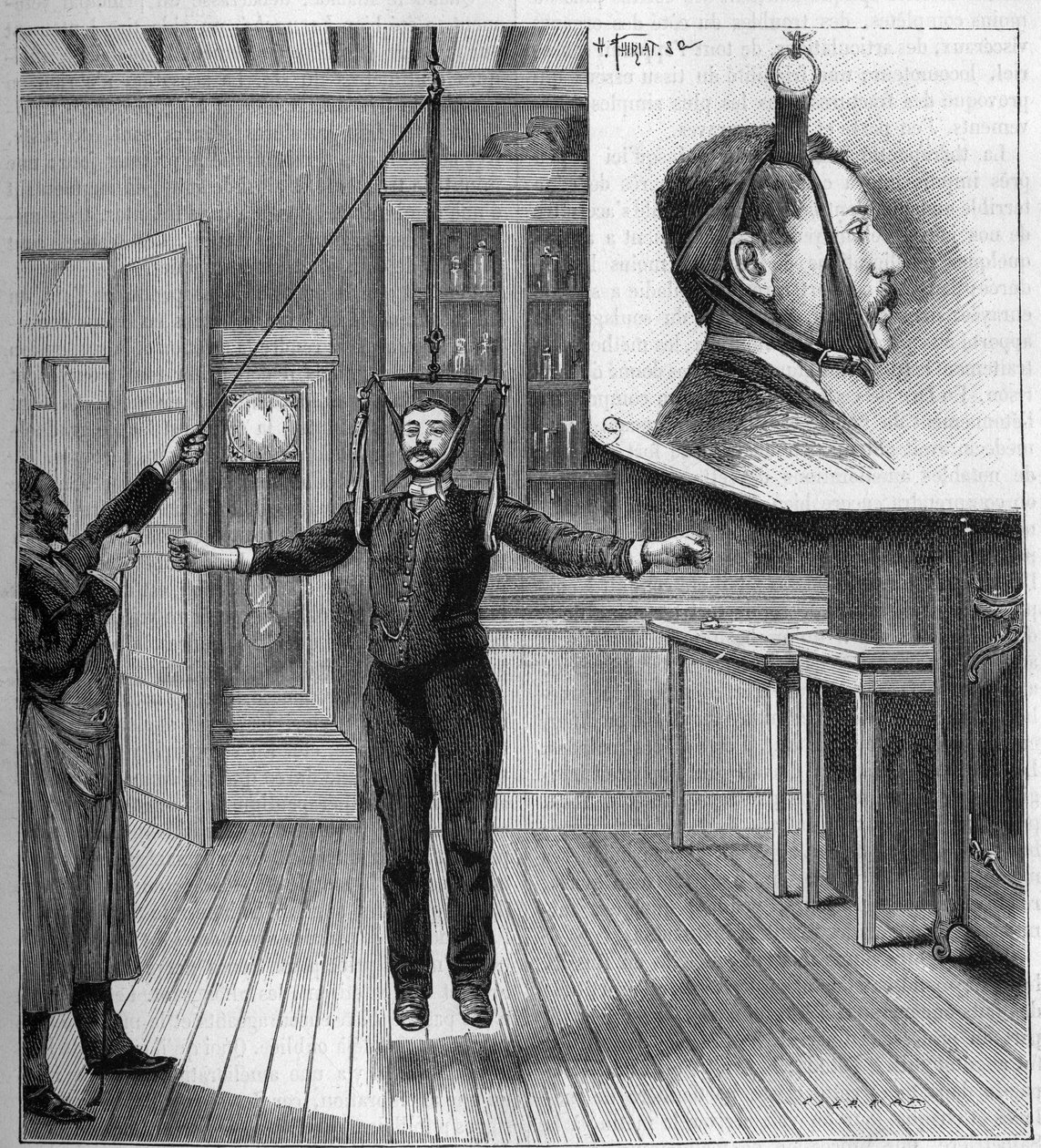 Medicína: léčba ataxie suspenzí v nemocnici Salpetriere v Paříži. Nahoře detail zařízení sloužící k péči. Gravírování v „“ La Nature. Revue des sciences et de ses applications aux arts et a l