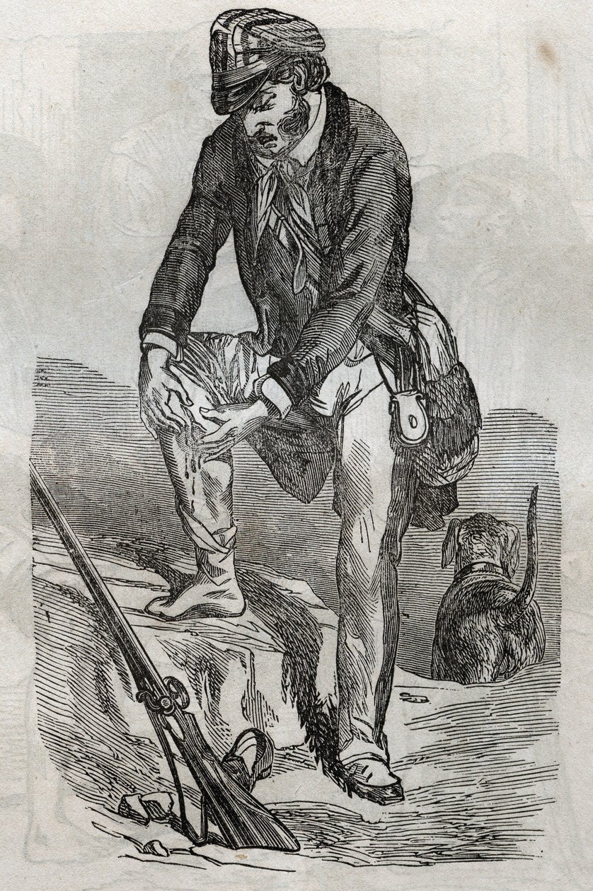 Rage – léčba kousnutí rozzuřeným zvířetem – bolí ho lisování rány – rytina v „La Sante Universelle – Medical Guide for Families““ 1852 od Unknown artist
