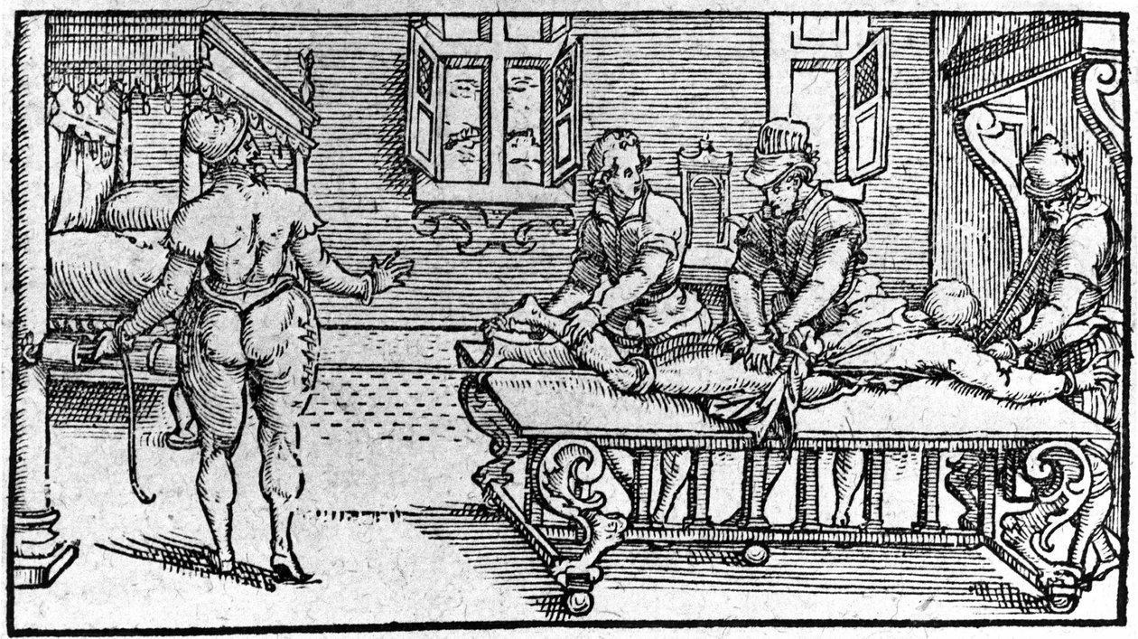 Redukce dislokace, v „Traité Médical“ od Ambroise Paré, kolem roku 1560. od Unknown artist