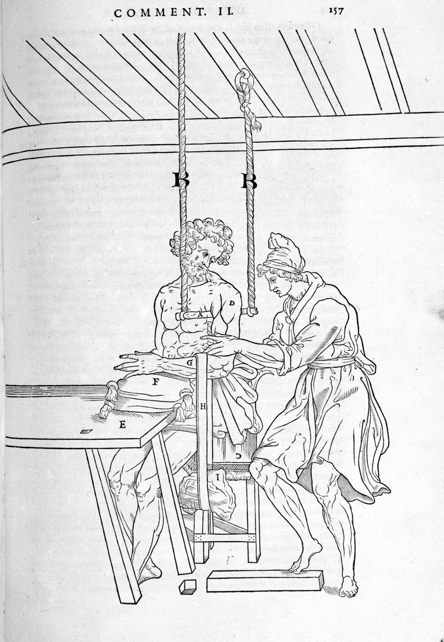 Redukce zlomenin. Deska s vyobrazením „Pitva lidského těla na tři části...“ od Carlo Stefano Riverio, Paříž 1545 od Unknown artist