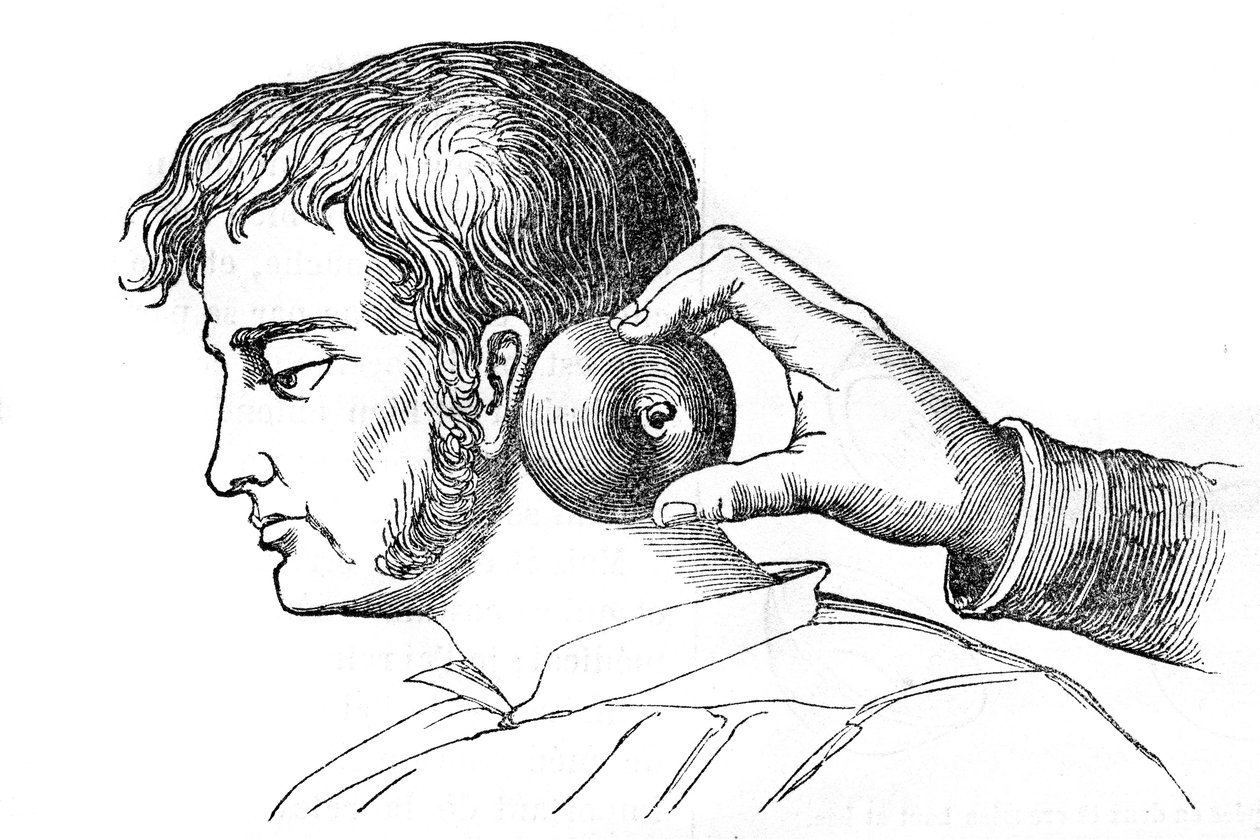 Saignee locales – aplikace pijavic s jablkem – rytina v „La Santo Universelle – Medical Guide for Families““ 1852 od Unknown artist