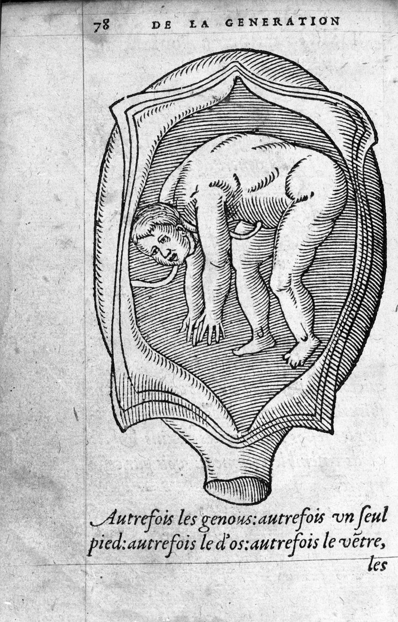 Poloha plodu v děloze během těhotenství. Rytina z „“De la generation des enfants““ od francouzského lékaře a chirurga Ambroise Pare (1509-1590) 16. století od Unknown artist