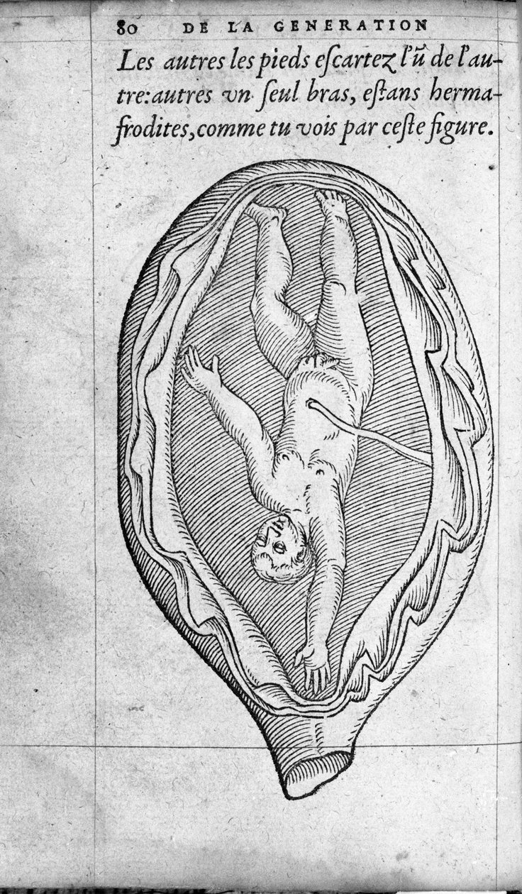 Poloha plodu v děloze během těhotenství. Rytina z „“De la generation des enfants““ od francouzského lékaře a chirurga Ambroise Pare (1509-1590) 16. století od Unknown artist