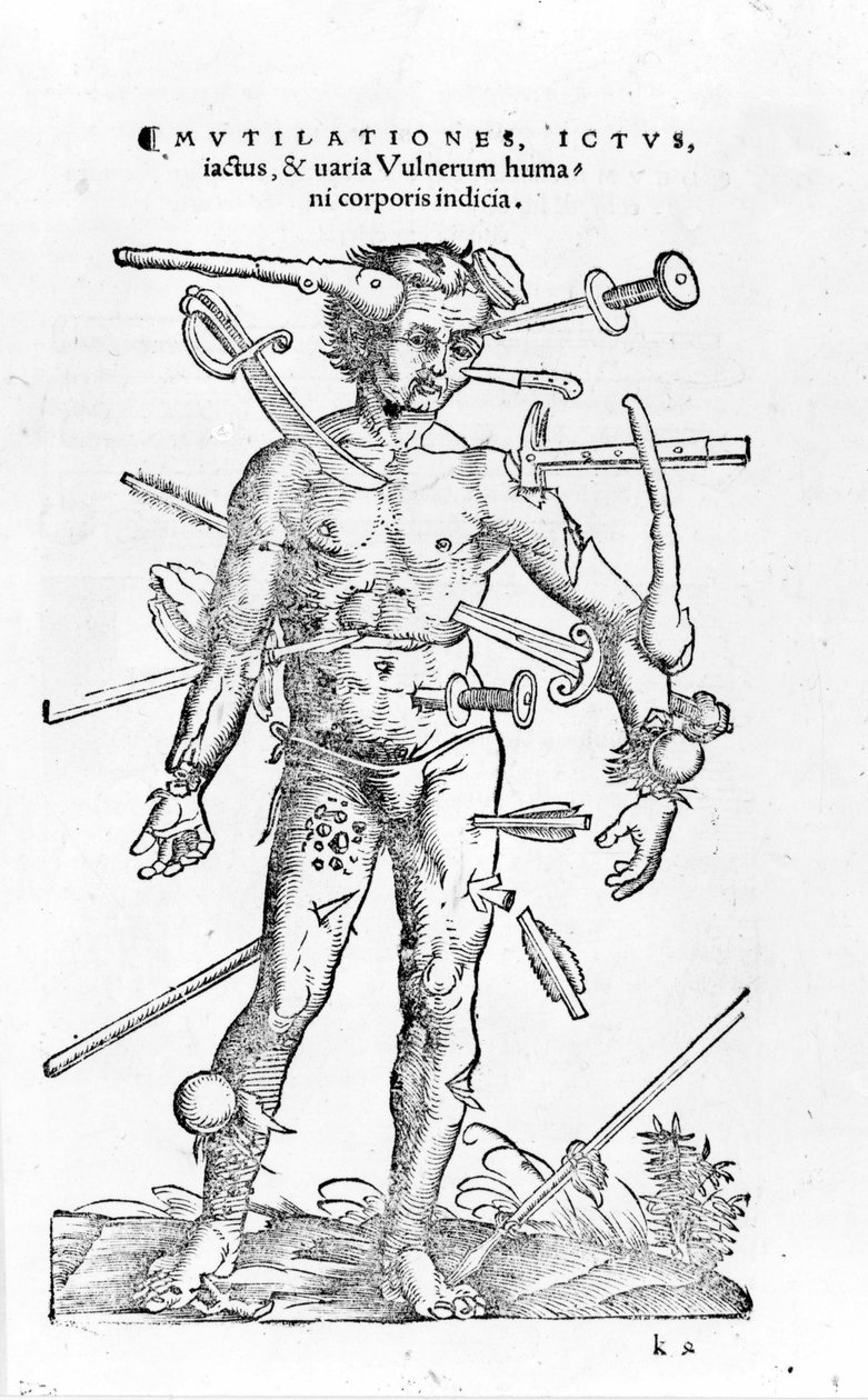 Všechny druhy traumatických válečných zranění. 16. století od Unknown artist